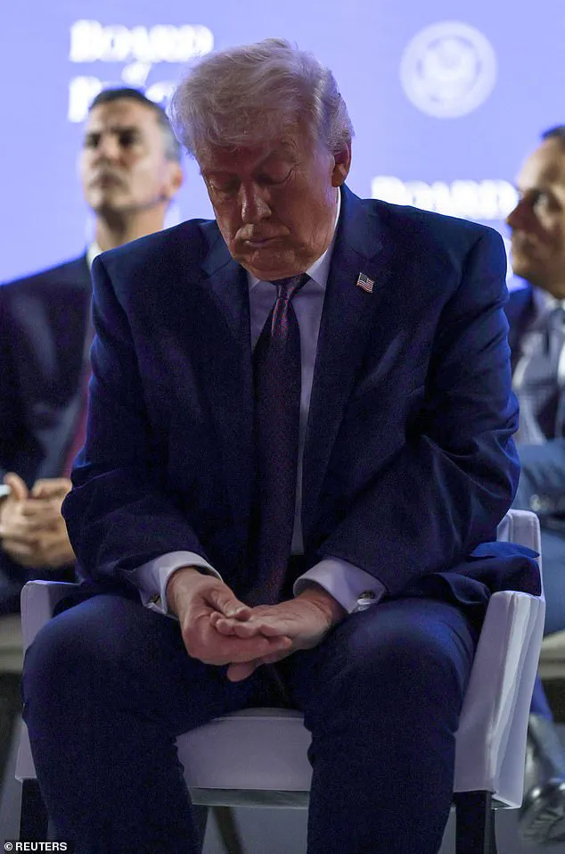 Trump Claims Davos Bruise from 'Clipping Table,' Experts Question Explanation
