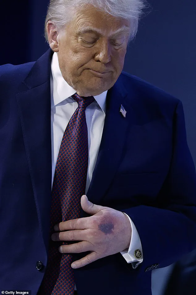 Trump Dismisses Alzheimer's Concerns, Struggles to Name Condition During Interview, Citing Father's Dementia