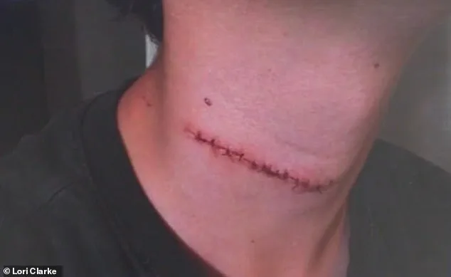 Chilling Attack Shatters Family's Daytona Beach Getaway: Teen Suffers Fatal Slashing