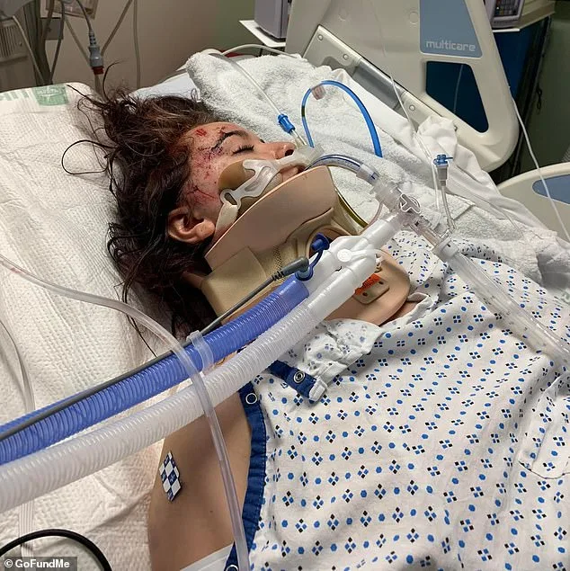 Oklahoma Crash Survivor Faces Lifelong Scars as Drunk Driver's Early Release Sparks Debate