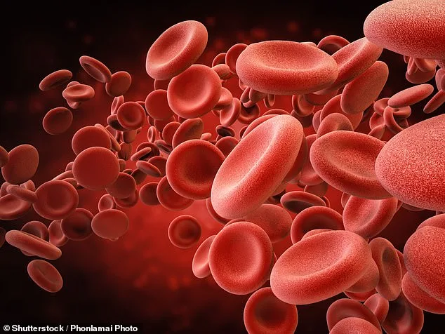 Iron Deficiency Linked to Alzheimer's Risk