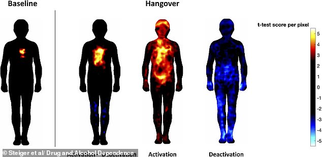 New maps reveal how alcohol dulls limbs while intensifying head pain.